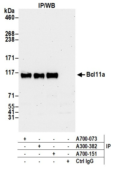 Bcl11a Antibody in Immunoprecipitation (IP)