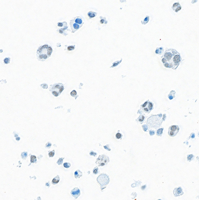 BRD9 Antibody in Immunocytochemistry (ICC/IF)