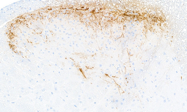 CGRP Antibody in Immunohistochemistry (Paraffin) (IHC (P))