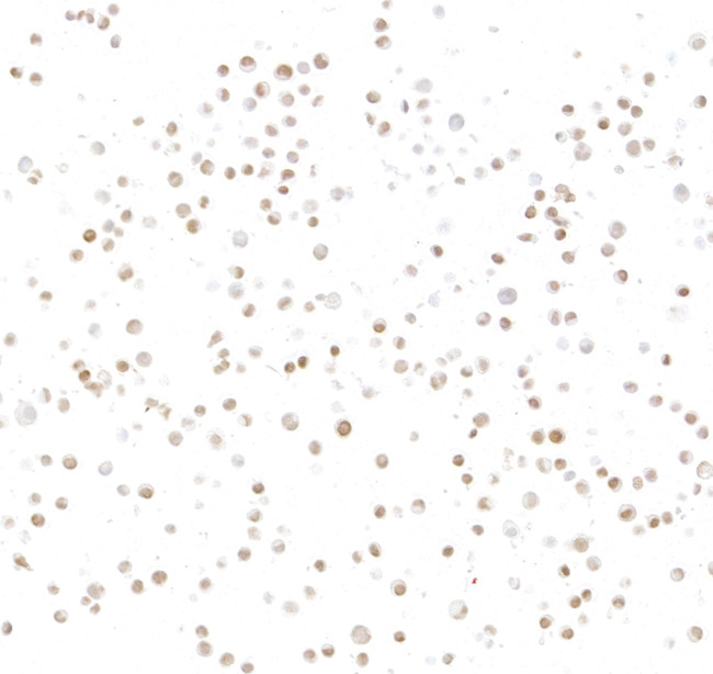 ASCL1/MASH1 Antibody in Immunocytochemistry (ICC/IF)