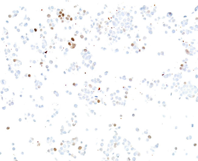 ASCL1/MASH1 Antibody in Immunocytochemistry (ICC/IF)