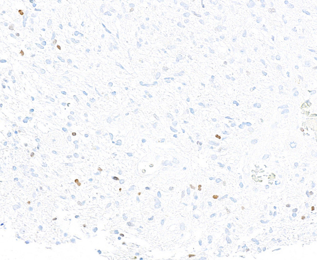 ASCL1/MASH1 Antibody in Immunohistochemistry (Paraffin) (IHC (P))