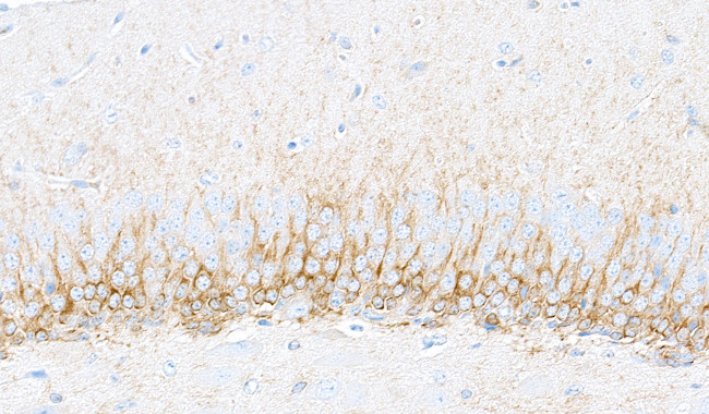 Doublecortin Antibody in Immunohistochemistry (Paraffin) (IHC (P))