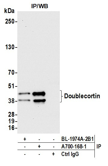 Doublecortin Antibody in Immunoprecipitation (IP)