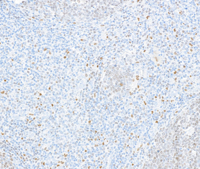 PU.1 Antibody in Immunohistochemistry (IHC)