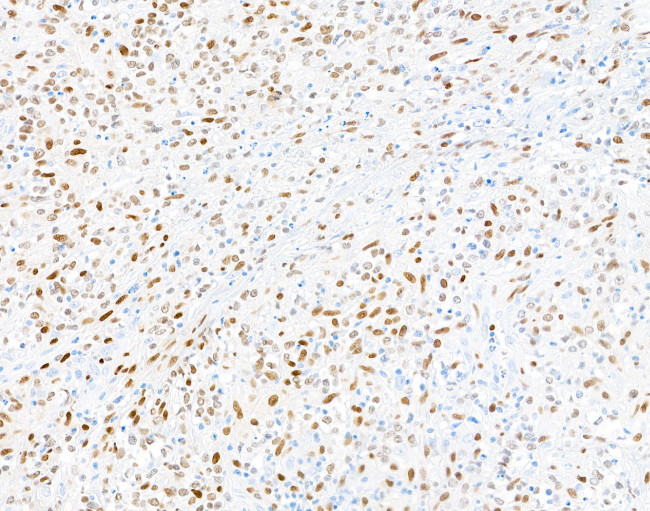 PU.1 Antibody in Immunohistochemistry (IHC)