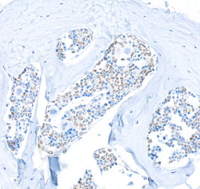 PU.1 Antibody in Immunohistochemistry (IHC)