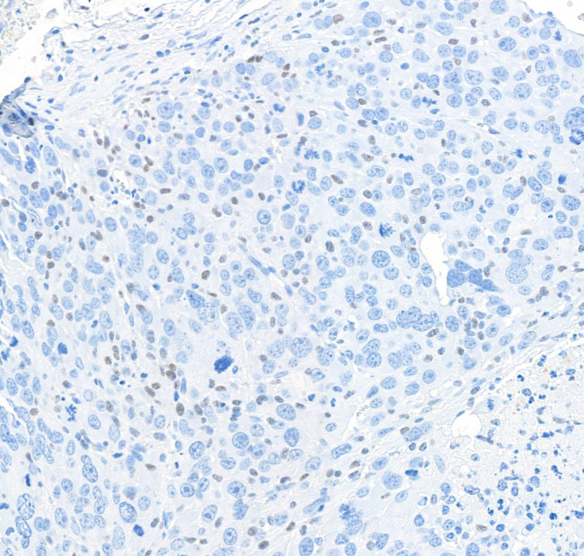 PU.1 Antibody in Immunohistochemistry (IHC)