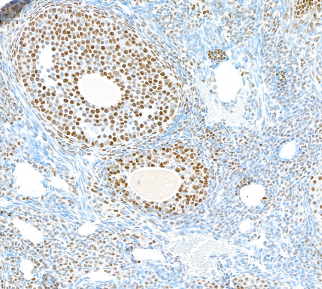 PARP1 Antibody in Immunohistochemistry (IHC)