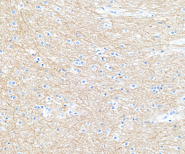 NF-H Antibody in Immunohistochemistry (IHC)