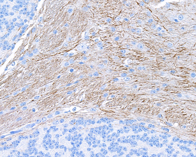 NF-H Antibody in Immunohistochemistry (IHC)