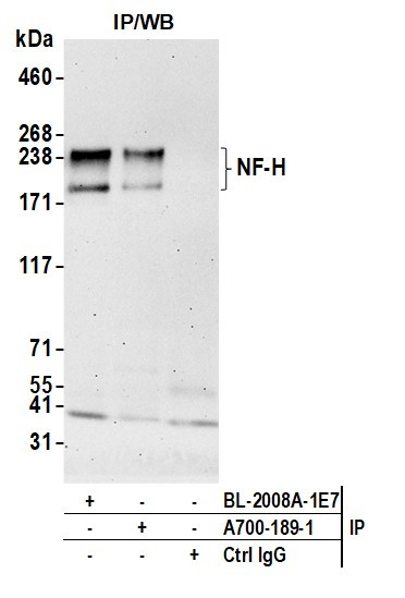 NF-H Antibody in Immunoprecipitation (IP)