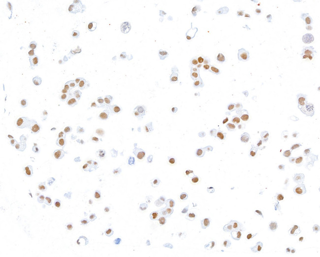 ThPOK Antibody in Immunocytochemistry (ICC/IF)