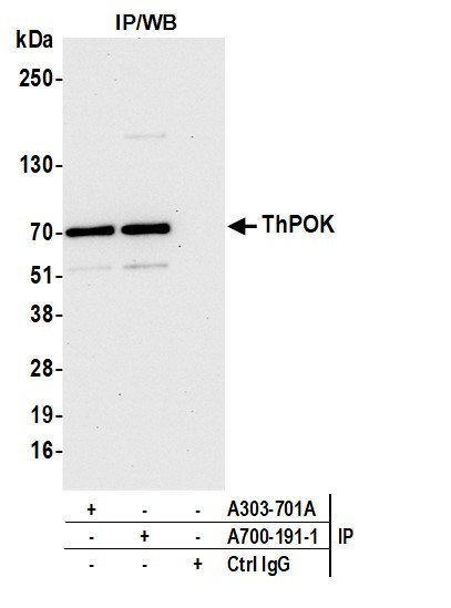 ThPOK Antibody in Immunoprecipitation (IP)
