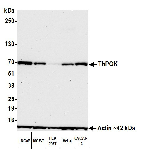 ThPOK Antibody in Western Blot (WB)