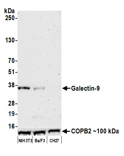 Galectin-9/Gal-9 Antibody in Western Blot (WB)