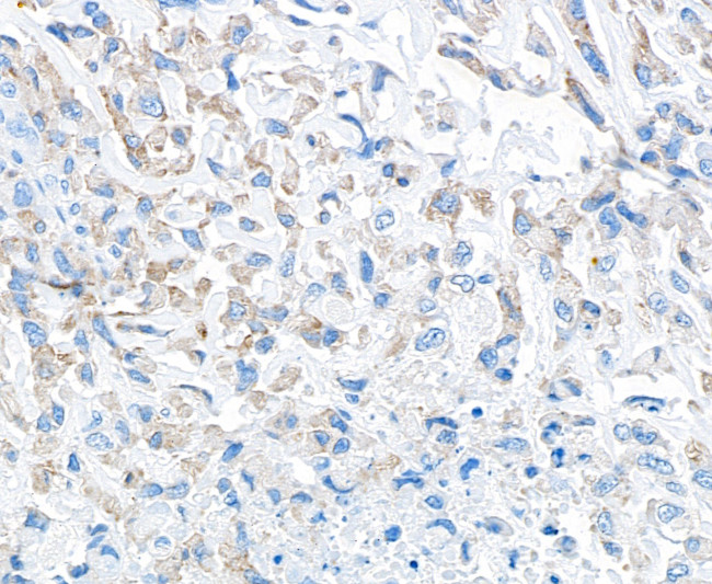 TGF-beta 1 Antibody in Immunohistochemistry (Paraffin) (IHC (P))