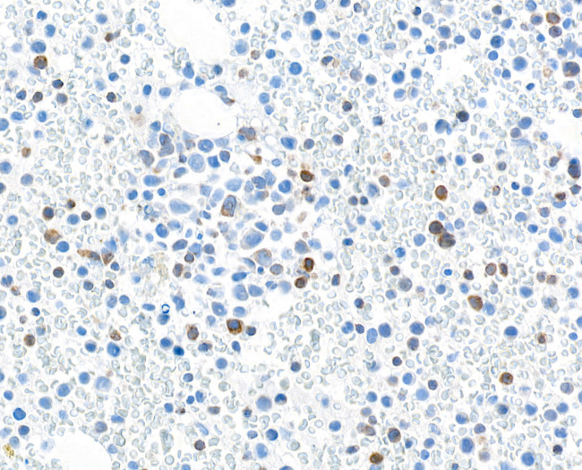 TGF-beta 1 Antibody in Immunohistochemistry (Paraffin) (IHC (P))