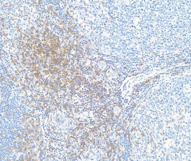 CD28 Antibody in Immunohistochemistry (Paraffin) (IHC (P))