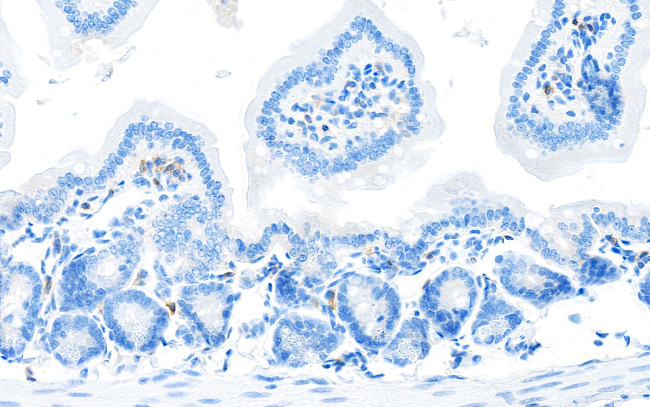 CD28 Antibody in Immunohistochemistry (Paraffin) (IHC (P))