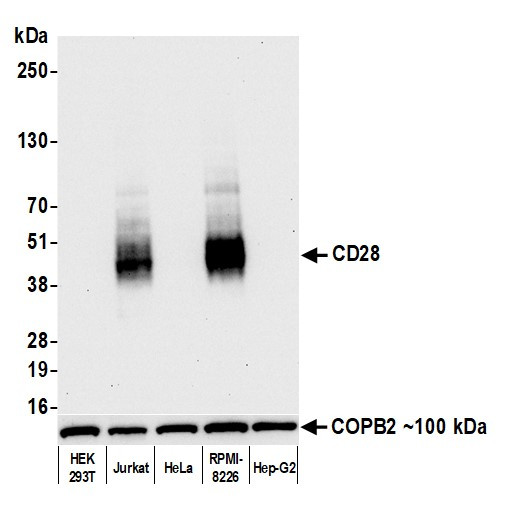 CD28 Antibody in Western Blot (WB)