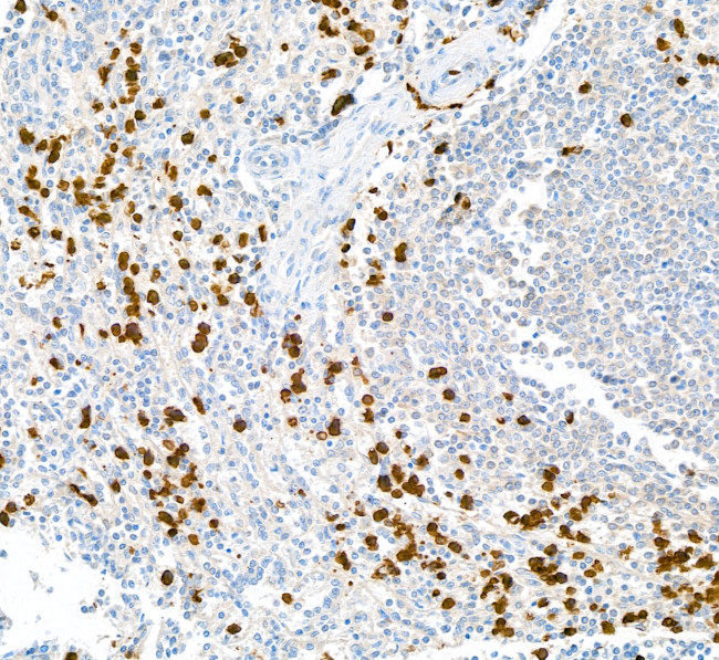 S100A9 Antibody in Immunohistochemistry (Paraffin) (IHC (P))