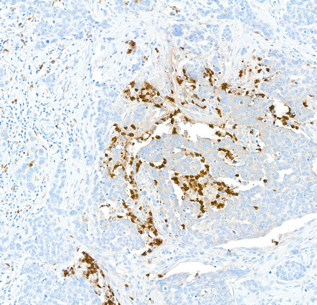 S100A9 Antibody in Immunohistochemistry (Paraffin) (IHC (P))