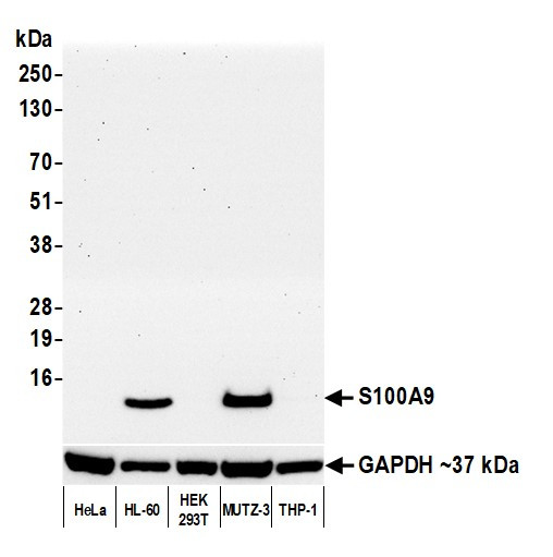 S100A9 Antibody in Western Blot (WB)