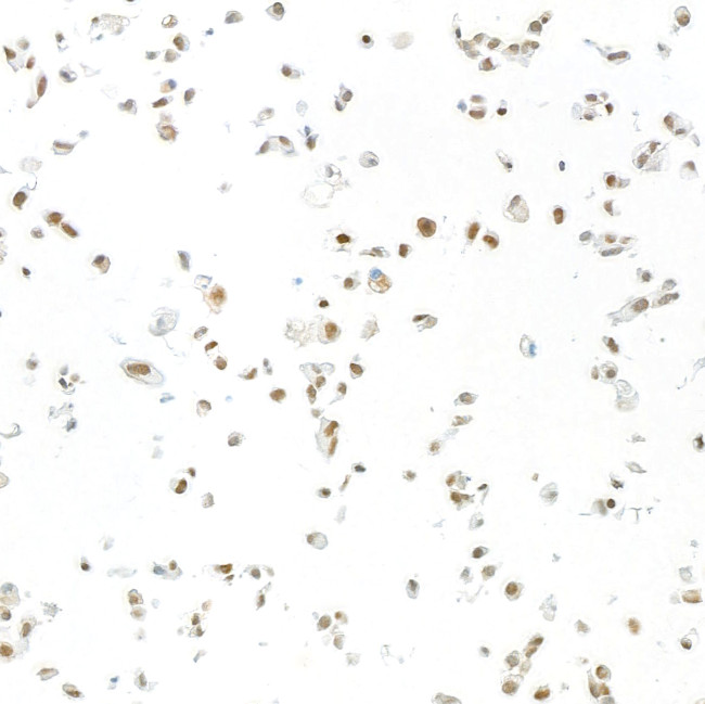 FOX2/RBM9 Antibody in Immunocytochemistry (ICC/IF)