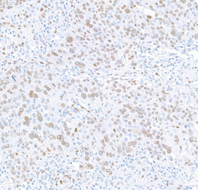 FOX2/RBM9 Antibody in Immunohistochemistry (Paraffin) (IHC (P))