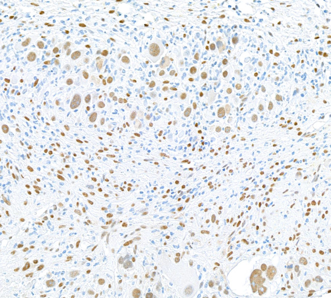 FOX2/RBM9 Antibody in Immunohistochemistry (Paraffin) (IHC (P))