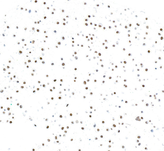 ZEB1 Antibody in Immunocytochemistry (ICC/IF)