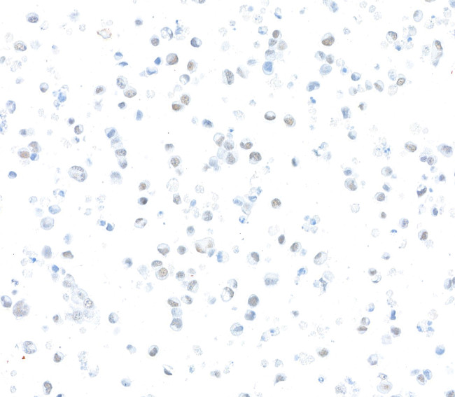 ZEB1 Antibody in Immunocytochemistry (ICC/IF)