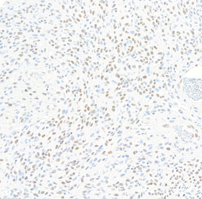 ZEB1 Antibody in Immunohistochemistry (Paraffin) (IHC (P))