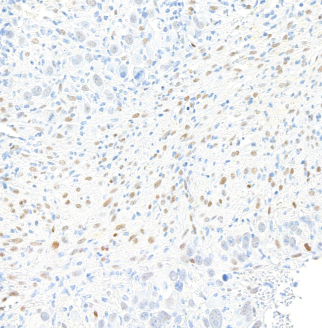 ZEB1 Antibody in Immunohistochemistry (Paraffin) (IHC (P))