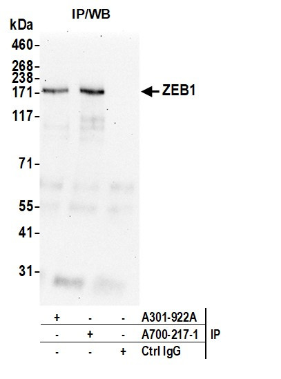 ZEB1 Antibody in Immunoprecipitation (IP)