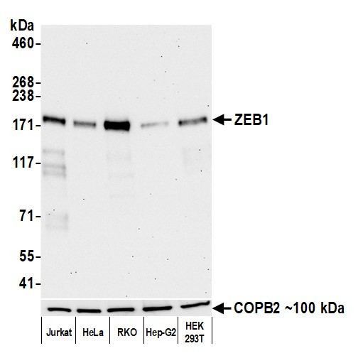 ZEB1 Antibody in Western Blot (WB)