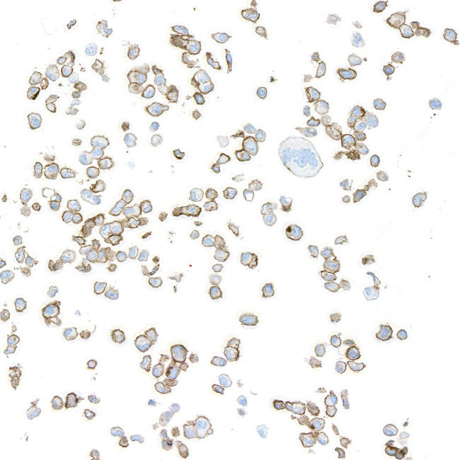 AXL Antibody in Immunocytochemistry (ICC/IF)