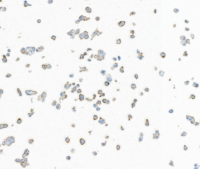 AXL Antibody in Immunocytochemistry (ICC/IF)