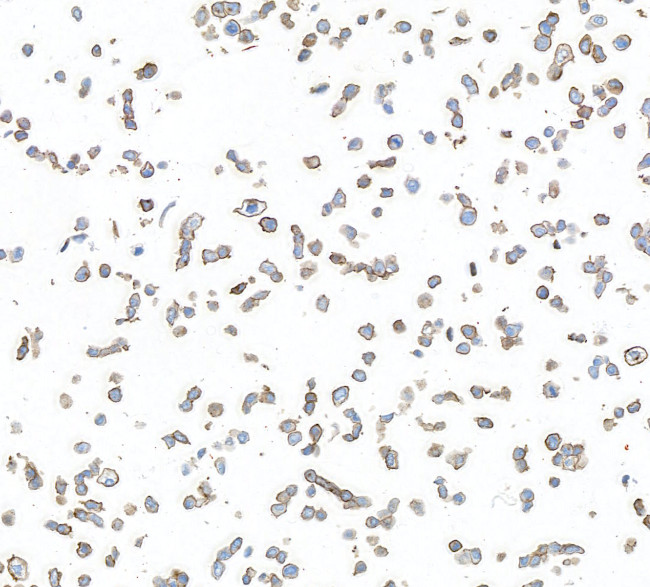 AXL Antibody in Immunocytochemistry (ICC/IF)