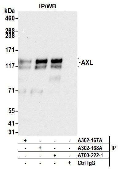 AXL Antibody in Immunoprecipitation (IP)