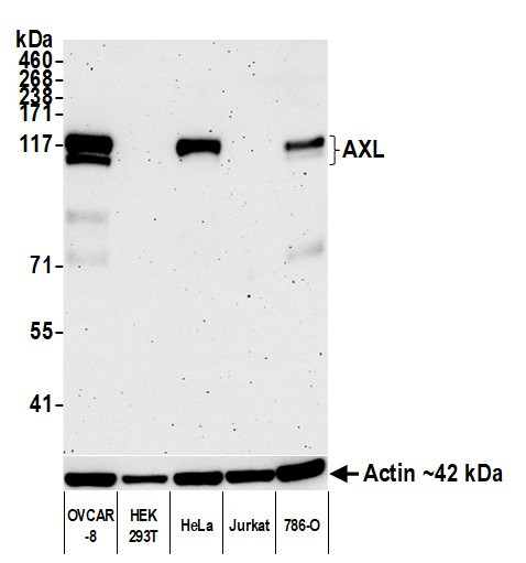 AXL Antibody in Western Blot (WB)