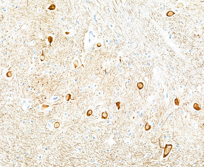 Neurofilament-L Antibody in Immunohistochemistry (Paraffin) (IHC (P))