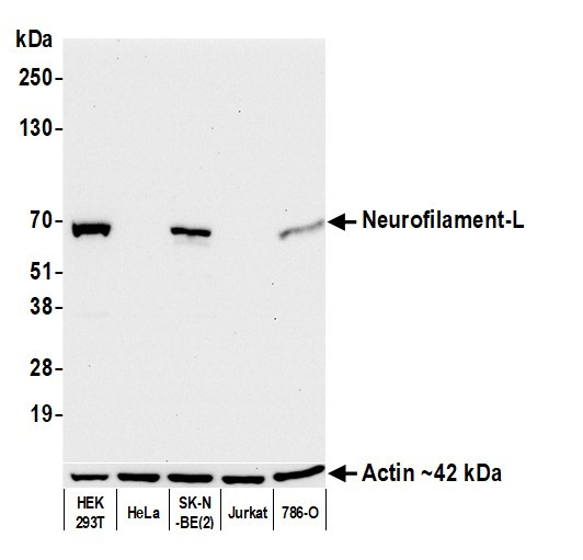 Neurofilament-L Antibody in Western Blot (WB)
