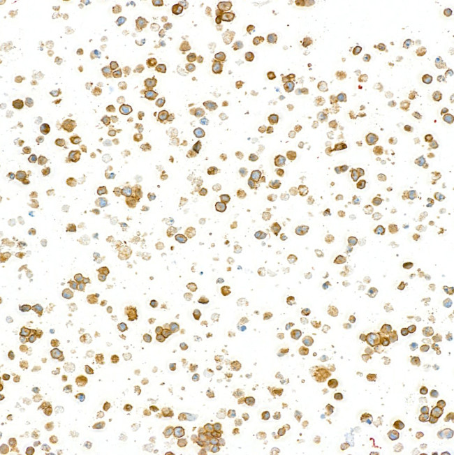 CD79B Antibody in Immunocytochemistry (ICC/IF)