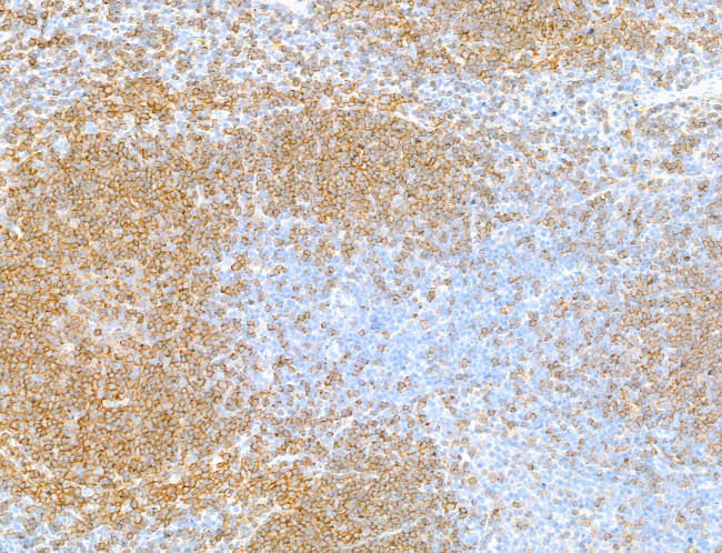 CD79B Antibody in Immunohistochemistry (Paraffin) (IHC (P))