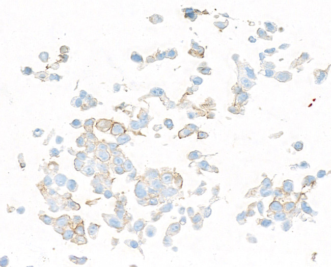 PDGFR beta Antibody in Immunocytochemistry (ICC/IF)