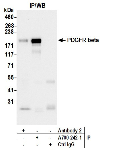 PDGFR beta Antibody in Immunoprecipitation (IP)