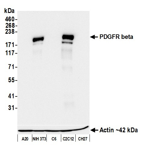 PDGFR beta Antibody in Western Blot (WB)