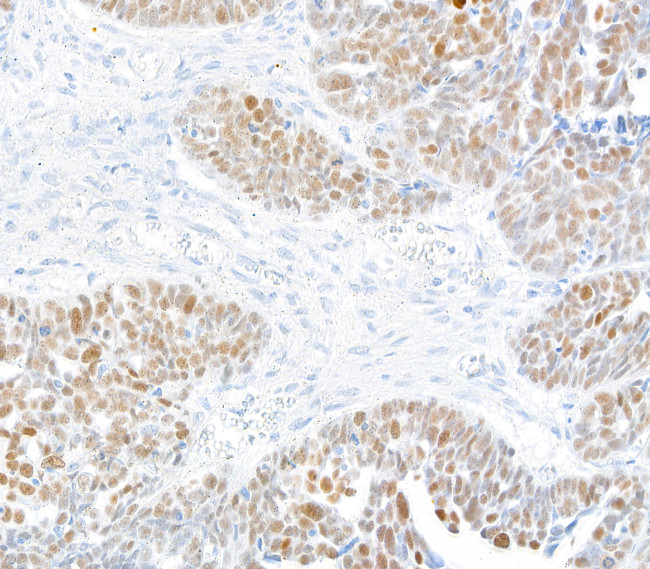 KLF5 Antibody in Immunohistochemistry (Paraffin) (IHC (P))